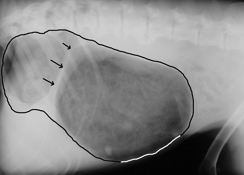 Unterbauch dicker harter Blähbauch vor